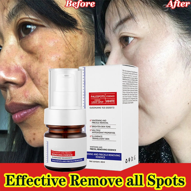 ⚡5-second brightening rescue: Dark spots disappear, blemishes fade, and skin becomes radiant! Vitamin C Whitening Freckles